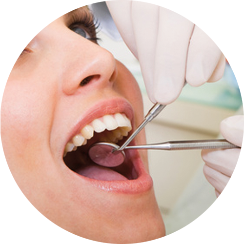 Empastes dentales en Talavera de la Reina Clínica dental Sevilleja